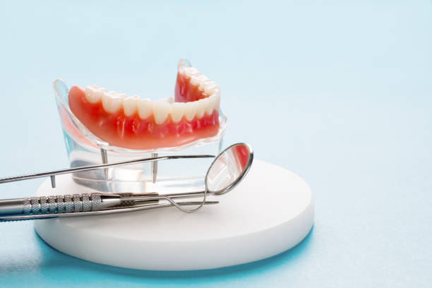Dental Inlays and Onlays in Kensington Park, FL